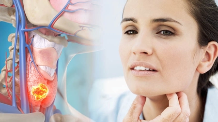 Care sunt primele simptome ale cancerului de gât? Află de ce este importantă diagnosticarea precoce