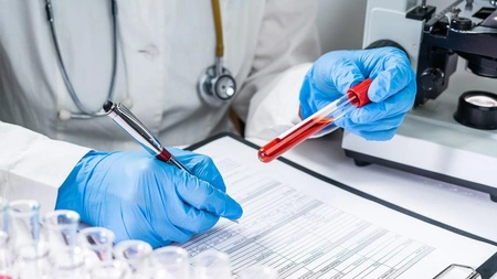 Ce analize de sânge se fac pentru infecții? Află cum știi că ai o inflamație în corp!