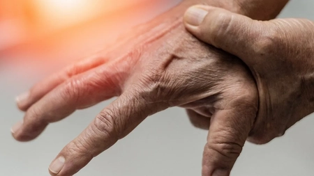 Unguent pentru tendinită. Cum să recunoști și să tratezi eficient inflamația tendonului