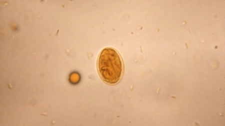 Laboratoarele Praxis : Giardia intestinalis - un parazit invizibil care îți poate afecta sănătatea. Cum se poate  depista corect?