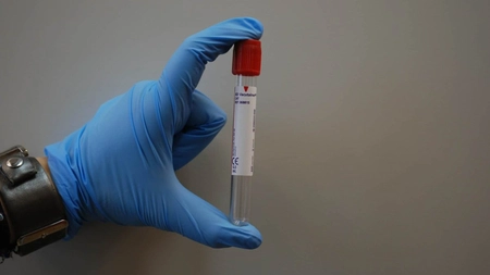 Care sunt afecțiunile hematologice ce pot apărea atât la adulți, cât și la copii? Iată toate semnele și simptomele acestora pe care trebuie să le cunoști
