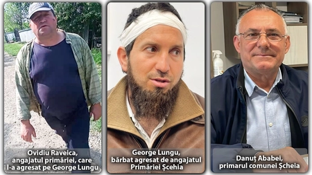 Scandal în comuna Șcheia! Angajatul primăriei i-a spart capul unui localnic, în plină zi. George Lungu: „S-a năpustit asupra mea, mi-a țâșnit sângele. Și-a arătat părțile genitale, l-am filmat”