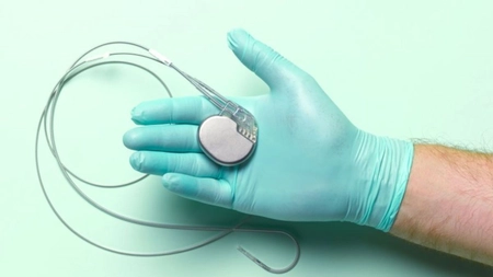 Ce preț are un implant de stimulator cardiac? Iată care este rata de succes a procedurii!