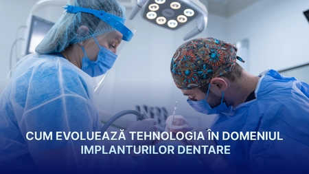Cum evoluează tehnologia în domeniul implanturilor dentare