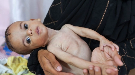Locuitorii din Gaza mor de foame! Sunt „cadavre ambulante” pe măsură ce cazurile de malnutriție cresc, spune șeful UNRWA