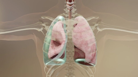În cât timp se vindecă pneumotoraxul? Iată tot ce trebuie să știi despre recuperare