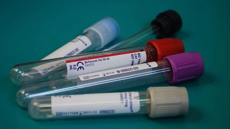 Infecțiile care scad numărul de limfocite! Ce boli se pot ascunde în spatele acestor valori