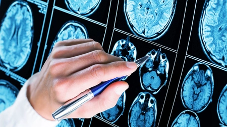 Studiu tulburător: pandemia a accelerat îmbătrânirea creierului! Cine e cel mai afectat