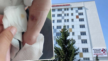 O mămică le aduce acuzații grave asistentelor de la Spitalul de Copii din Iași! Din cauza neglijenței lor, bebelușul său a ajuns să aibă piciorul plin de răni: „Mai aveau un pic și săreau la bătaie”