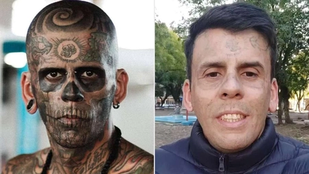 Omul cu 170 de tatuaje pe 95% din corp își șterge întreaga viață de pe piele. Durerea e infernală