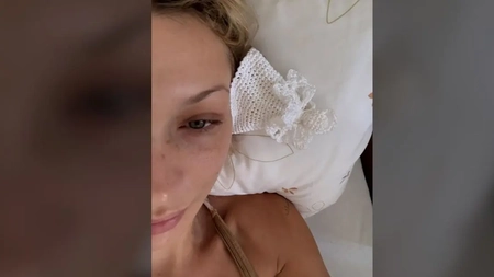 Luptă pentru viață! O cunoscută vedetă, doborâtă de boala Lyme: „Handicapul invizibil al bolii”