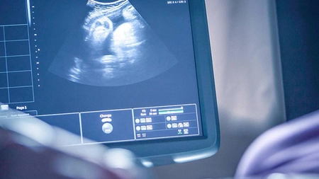 Doctorii nu puteau să creadă ce au văzut în timpul ecografiei. Dar când s-a născut bebelușa, farmecul, forța și povestea ei au atins inimile oamenilor din întreaga lume în cel mai neașteptat mod