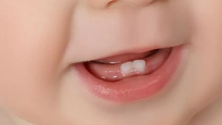 Erupția dentară la bebeluși – Iată tot ce trebuie să știi ca părinte despre această etapă