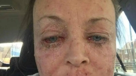 Dependența de alcool i-a distrus viața! Viciul a dus-o într-o stare critică pe o mamă de 46 de ani