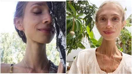 A vrut să slăbească, dar și-a pierdut viața! O tânără de 27 de ani a murit după o dietă cu fructe. Corpul ei ajunsese la doar 22 de kilograme!