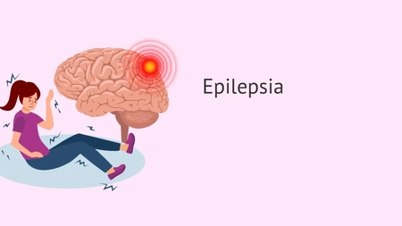 Care sunt simptomele epilepsiei? Iată toate detaliile despre această boală cronică a creierului!