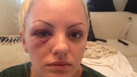 Alexandra Stan a fost agresată din nou! Ce i-a făcut fostul iubit