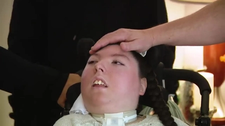 O fată născută fără creier a împlinit 20 de ani! Medicii i-au dat doar 4 ani de viață