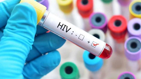 Cât trăiesc bolnavii de SIDA? Iată tot ce trebuie să știi despre speranța de viață a persoanelor infectate cu HIV