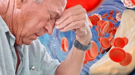 În ce constă curățarea vaselor de sânge? Află cum poți elimina depozitul de grăsime și colesterol!