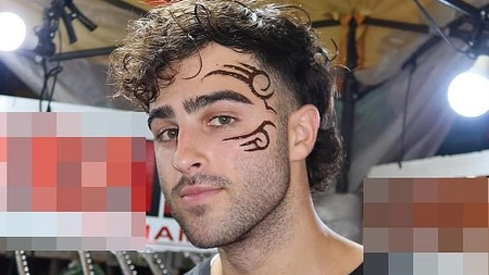 Un tatuaj cu henna i-a lăsat răni grave pe față unui băiat! Medicii trag un semnal de alarmă!