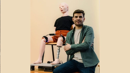 Un bioinginer din Iași a conceput o proteză unică în lume! Dispozitivul medical crește odată cu pacientul protezat: „AdapTra este un concept nou”