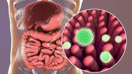 Simptomele rotavirus la adulți. Iată cum se manifestă și ce măsuri sunt recomandate!