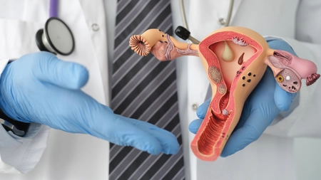 Col uterin inflamat – poze și semne de alarmă pe care nu trebuie să le ignori! Află de ce apare această afecțiune!