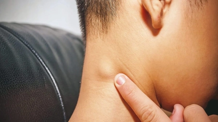 De ce se umflă ganglionii limfatici de la gât? Iată cum știi dacă semnalează o infecție banală sau un cancer!