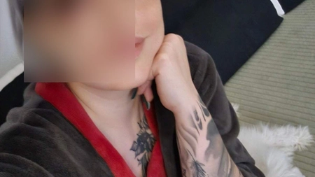 Imagini șocante cu o influenceriță din România! Aceasta a apărut pe rețelele de socializare cu fața mutilată