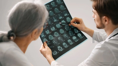 Care sunt cauzele care duc la un lacunarism cerebral? Iată simptomele la care trebuie sa fii atent!