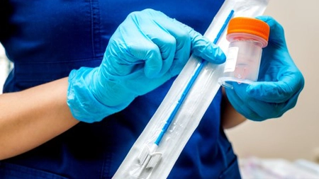 Ce presupune un test Papanicolau? Iată care este importanța lui și de ce trebuie făcut!