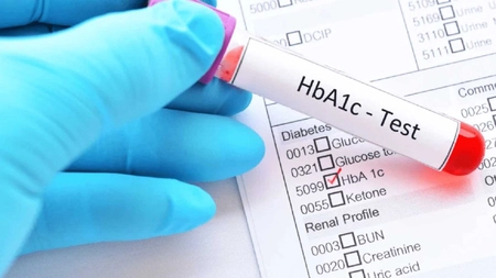 Ce simptome apar când ai hemoglobina glicozilată mare? Dr. Oana Cuzino explică la ce trebuie să fim atenți!
