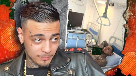 Albert NBN, operat de urgență din cauza apendicitei. Ce au descoperit medicii și cum se simte acum