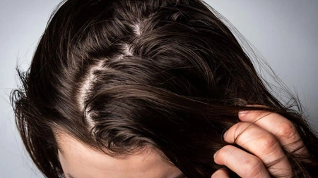 De ce se îngrașă părul? Află care este motivul și ce poți face acasă!