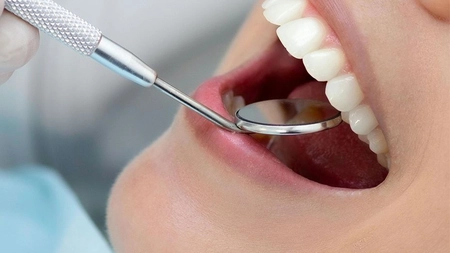 Investiția în viitorul zâmbetului: De ce materialele premium contează pentru longevitatea fațetelor dentare