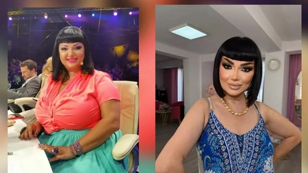 Cum arată Ozana Barabancea după ce și-a operat bustul. Fanii au taxat-o grav: „Doamnă, v-ați pierdut umărul în edit”