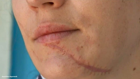 Și-a mutilat soția, care riscă să rămână cu cicatrici! „A bătut-o cu pumnii și picioarele, apoi a tăiat-o!”