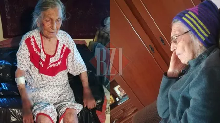 Familia unei bătrâne face acuzații grave la adresa medicilor ieșeni! Femeia a ajuns la spital pe picioarele ei și a fost externată cu vânătăi, nu mai vorbește și stă în pat ca o legumă - FOTO