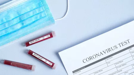 Coronavirus: persoanele asimptomatice își pierd anticorpii mai repede