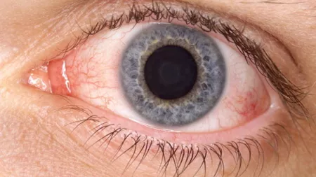 Ochiul uman pare rezistent la SARS-CoV-2, au stabilit oamenii de stiinta