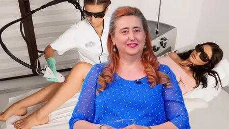 Pericolele la care se expun tinerele care apelează la epilarea cu laser. Prof. dr. Laura Solovăstru: 