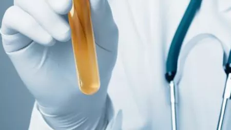 Leucocite în urină: Ce pericol reprezintă valorile mari și cum se tratează