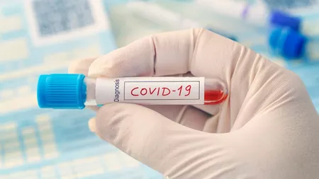 Imunitatea post-Covid-19: anticorpii rămân prezenți mai mult de un an după infecție