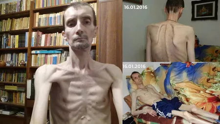 Această poveste îți rupe sufletul! Fostul jurist de la AJOFM Iași a supraviețuit patru ani fără să mănânce și fără să bea apă! Are 52 de ani și cântărește doar 30 de kilograme! 