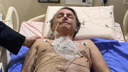 Președintele Braziliei, Jair Bolsonaro, a fost internat în spital pentru că sughița de două săptămâni