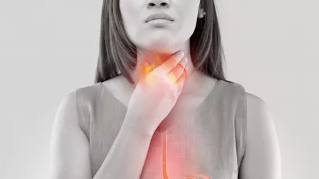 Boala de reflux gastroesofagian: Cum să scapi ușor de arsurile gastrice