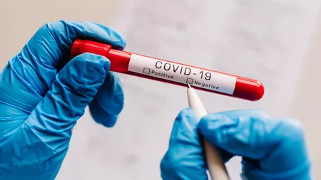 Persoanele trecute prin infecția cu Covid-19 au o imunitate mai mare față de cele vaccinate