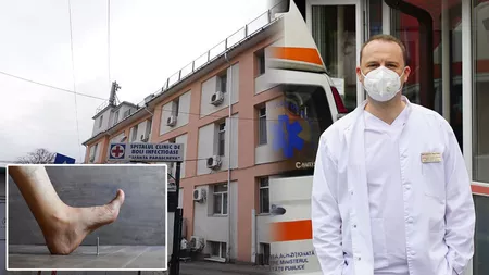 Primul pacient din acest an internat cu tetanos la Spitalul Clinic de Boli Infecțioase Iași! Boala poate provoca moartea