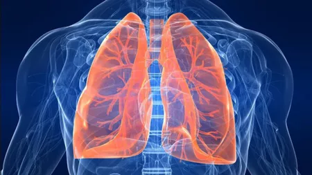 În cât timp se vindecă pneumonia – Cât este de periculoasă această afecțiune